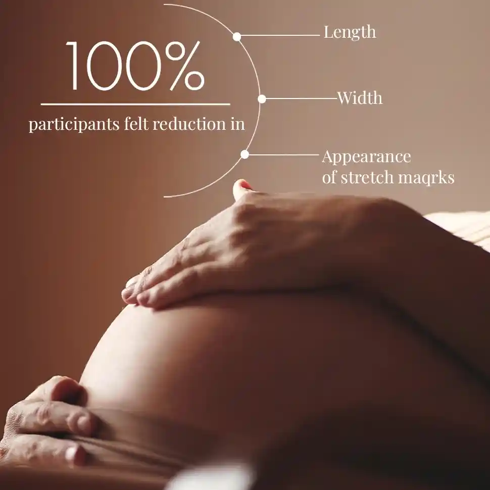 Stretch Marks Expert, Serum Cream, 30 ml - Image 11