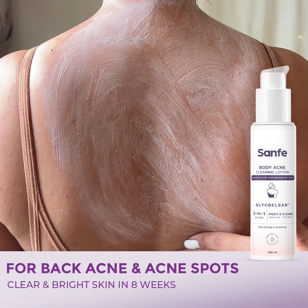 The Clear Skin Trio - Image 3